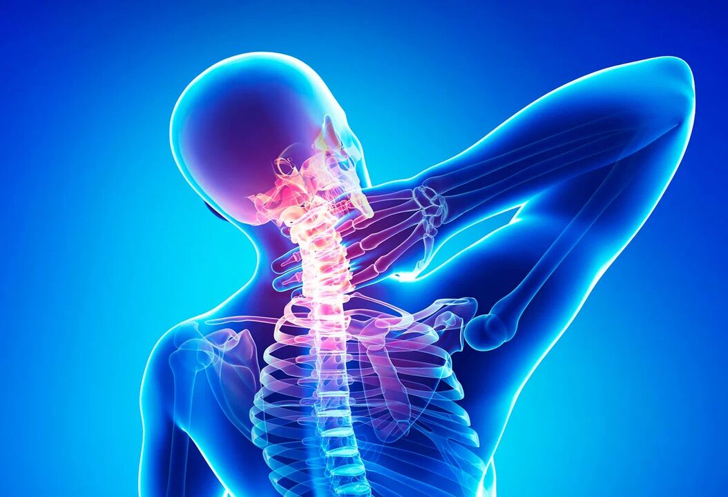 Osteochondroza kręgosłupa jest częstą chorobą wymagającą leczenia. 