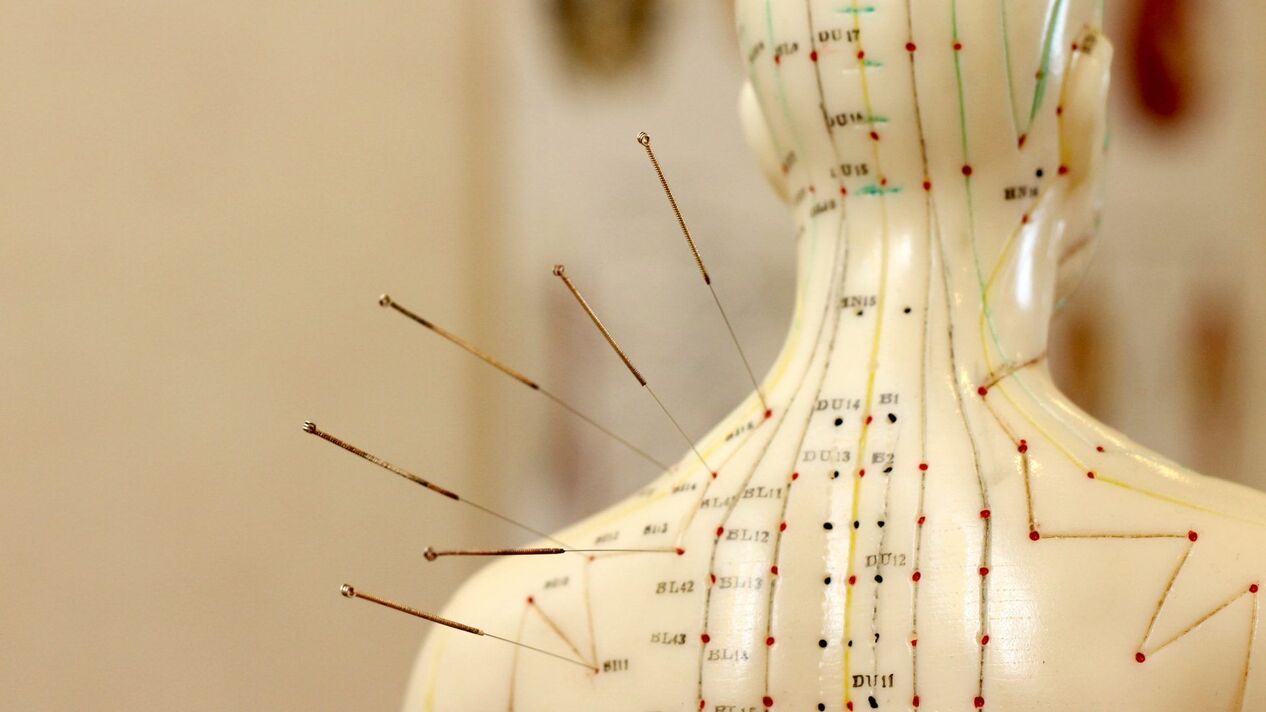 akupunktura w osteochondrozie szyjnej
